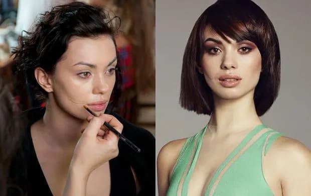 Czy modelka może mieć blizny? Przełamujemy stereotypy w modzie