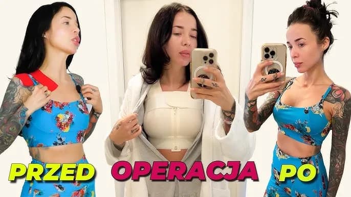 Czy operacja biustu jest bezpieczna? Oto, co musisz wiedzieć